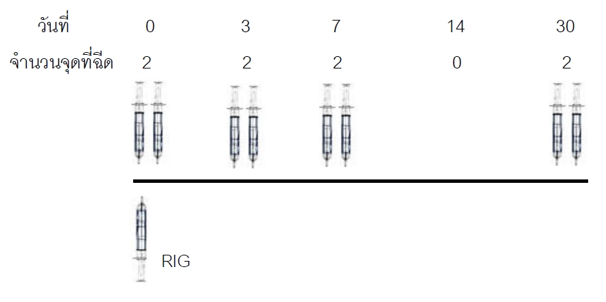 การฉีดแบบ 2-2-2-0-2